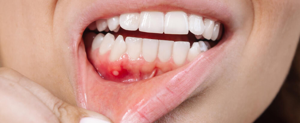 L'infection et le gonflement