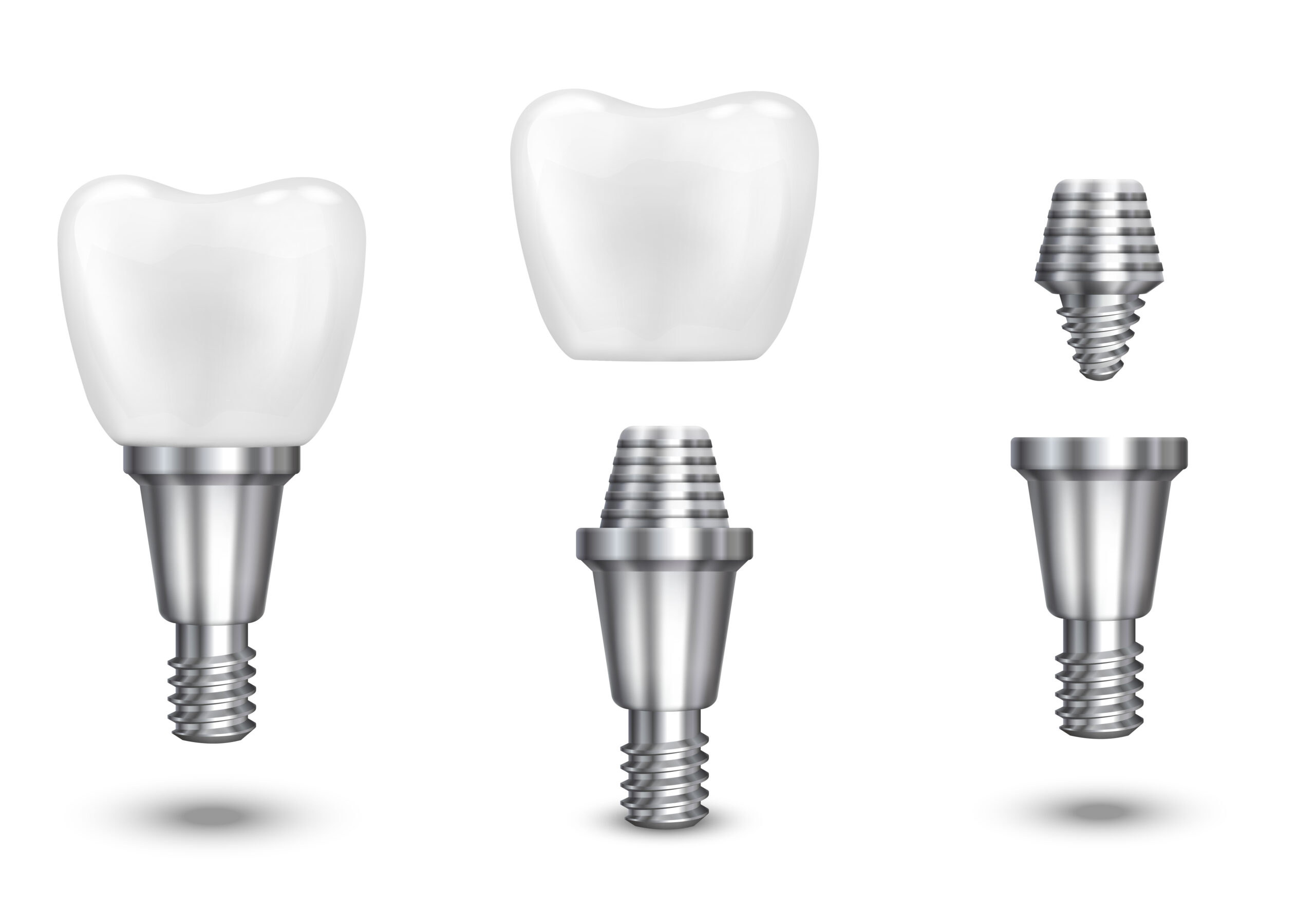 Pose de l'implant